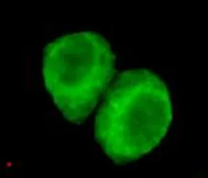 Anti-PSR antibody [3G5-G5-H8] used in Immunocytochemistry/ Immunofluorescence (ICC/IF). GTX49192