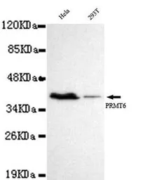 Anti-PRMT6 antibody [2C3-F1-G1] used in Western Blot (WB). GTX49197