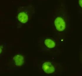 Anti-DBC1 antibody [3G4-D11-D7] used in Immunocytochemistry/ Immunofluorescence (ICC/IF). GTX49199