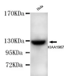 Anti-DBC1 antibody [3G4-D11-D7] used in Western Blot (WB). GTX49199