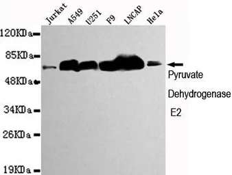 Anti-DLAT antibody [4A4-B6-C10] used in Western Blot (WB). GTX49202