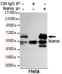 Anti-Ikaros antibody [1A12-F2-D8] used in Immunoprecipitation (IP). GTX49214