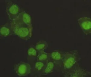 Anti-SAFB antibody [2E8-E2-G6] used in Immunocytochemistry/ Immunofluorescence (ICC/IF). GTX49227