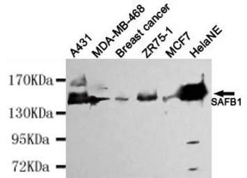 Anti-SAFB antibody [2E8-E2-G6] used in Western Blot (WB). GTX49227