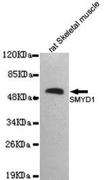 Anti-SMYD1 antibody [2E11-B6-C7] used in Western Blot (WB). GTX49237