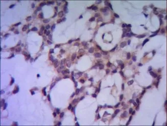 Anti-PPP1A antibody [1C11-C10-H5-E9] used in IHC (Paraffin sections) (IHC-P). GTX49238
