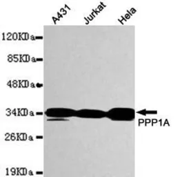 Anti-PPP1A antibody [1C11-C10-H5-E9] used in Western Blot (WB). GTX49238