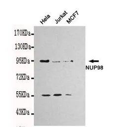 Anti-NUP98 antibody [3B8-D7-H10] used in Western Blot (WB). GTX49240