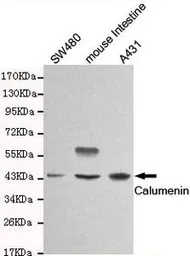 Anti-Calumenin antibody [4C6-G10-B12] used in Western Blot (WB). GTX49241