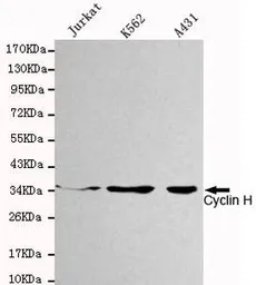 Anti-Cyclin H antibody [4E11-G2-D7] used in Western Blot (WB). GTX49246