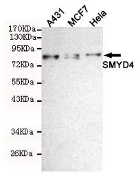 Anti-SMYD4 antibody [7C8-B11-F10] used in Western Blot (WB). GTX49257