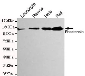 Anti-Phostensin antibody [4B12-E11-D9] used in Western Blot (WB). GTX49266