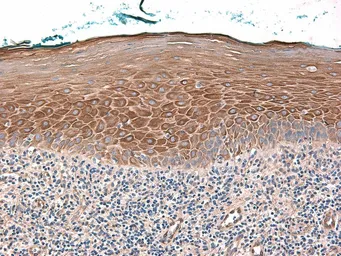 Anti-beta 2 Defensin antibody used in IHC (Paraffin sections) (IHC-P). GTX49324