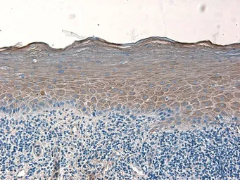 Anti-beta 2 Defensin antibody used in IHC (Paraffin sections) (IHC-P). GTX49324