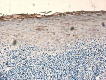 Anti-beta 2 Defensin antibody used in IHC (Paraffin sections) (IHC-P). GTX49324
