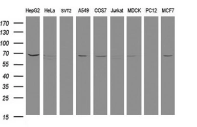 Anti-MTMR2 antibody [1F10] used in Western Blot (WB). GTX49357