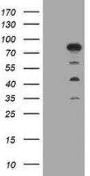 Anti-MTMR2 antibody [1F10] used in Western Blot (WB). GTX49357