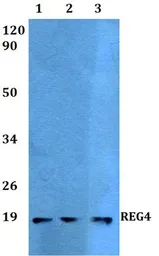 Anti-REG4 antibody used in Western Blot (WB). GTX49362
