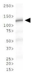 Anti-VLDL Receptor antibody [6A6] used in Western Blot (WB). GTX49372