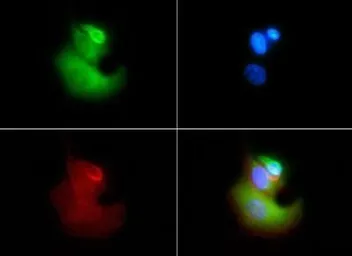 Anti-VLDL Receptor antibody [6A6] used in Immunocytochemistry/ Immunofluorescence (ICC/IF). GTX49372