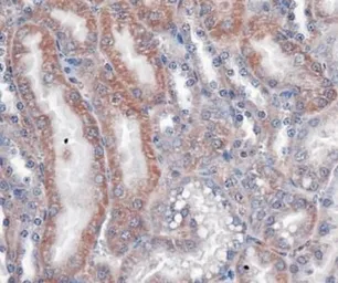 Anti-VLDL Receptor antibody [6A6] used in IHC (Paraffin sections) (IHC-P). GTX49372