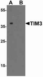 Anti-TIM-3 antibody used in Western Blot (WB). GTX49381