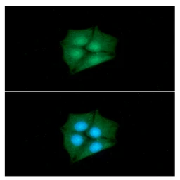 Anti-CRABP1 antibody [AT1A1] used in Immunocytochemistry/ Immunofluorescence (ICC/IF). GTX50013