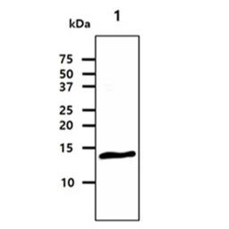 Anti-CRABP1 antibody [AT1A1] used in Western Blot (WB). GTX50013