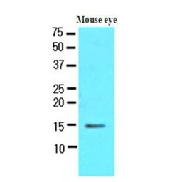 Anti-CRABP1 antibody [AT1A1] used in Western Blot (WB). GTX50013