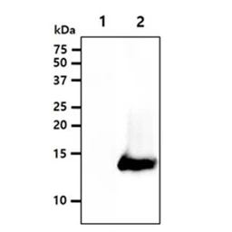 Anti-CRABP1 antibody [AT1A1] used in Western Blot (WB). GTX50013