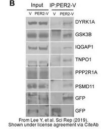 Anti-PSMD11 antibody [AT1F4] used in Western Blot (WB). GTX50018