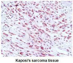 Anti-KSHV ORF73 antibody [AT4C11] used in IHC (Paraffin sections) (IHC-P). GTX50023