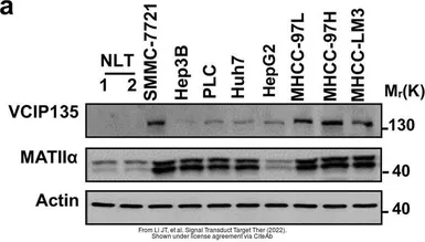 Anti-MAT2A antibody [AT3A2] used in Western Blot (WB). GTX50027