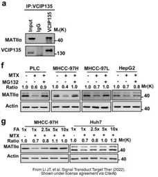 Anti-MAT2A antibody [AT3A2] used in Western Blot (WB). GTX50027