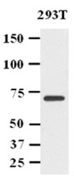 Anti-PPM1G antibody [k1G6] used in Western Blot (WB). GTX50041