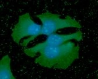 Anti-Podoplanin antibody [5E2] used in Immunocytochemistry/ Immunofluorescence (ICC/IF). GTX50043