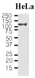 Anti-HSP105 antibody [J1G12] used in Western Blot (WB). GTX50045