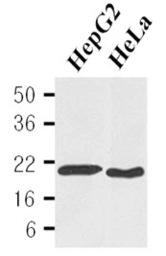 Anti-Cyclophilin B antibody [k2E2] used in Western Blot (WB). GTX50046