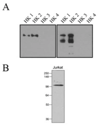 Anti-Hexokinse 1, 2 antibody [1A7] used in Western Blot (WB). GTX50052