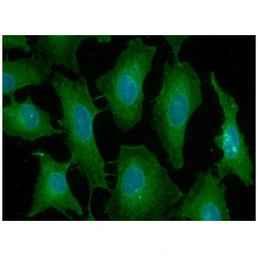 Anti-PD1 antibody [4F12] used in Immunocytochemistry/ Immunofluorescence (ICC/IF). GTX50053