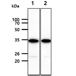 Anti-PD1 antibody [4F12] used in Western Blot (WB). GTX50053