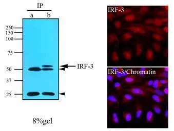 Anti-IRF3 antibody [3F10] used in Immunocytochemistry/ Immunofluorescence (ICC/IF). GTX50058