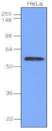 Anti-IRF3 antibody [3F10] used in Western Blot (WB). GTX50058