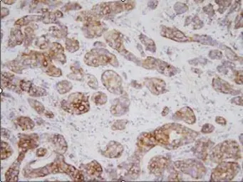 Anti-TPD52L1 antibody [d1C5] used in Immunohistochemistry (IHC). GTX50076