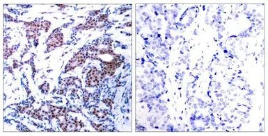 Anti-c-Jun (phospho Ser73) antibody used in IHC (Paraffin sections) (IHC-P). GTX50091