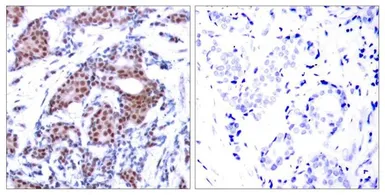 Anti-ELK1 (phospho Ser383) antibody used in IHC (Paraffin sections) (IHC-P). GTX50092