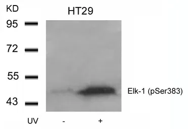 Anti-ELK1 (phospho Ser383) antibody used in Western Blot (WB). GTX50092