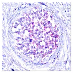Anti-Raf1 (phospho Ser259) antibody used in IHC (Paraffin sections) (IHC-P). GTX50094
