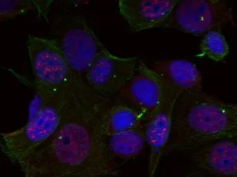 Anti-c-Rel (phospho Ser503) antibody used in Immunocytochemistry/ Immunofluorescence (ICC/IF). GTX50099