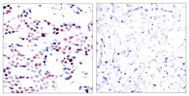 Anti-c-Jun (phospho Thr91) antibody used in IHC (Paraffin sections) (IHC-P). GTX50100